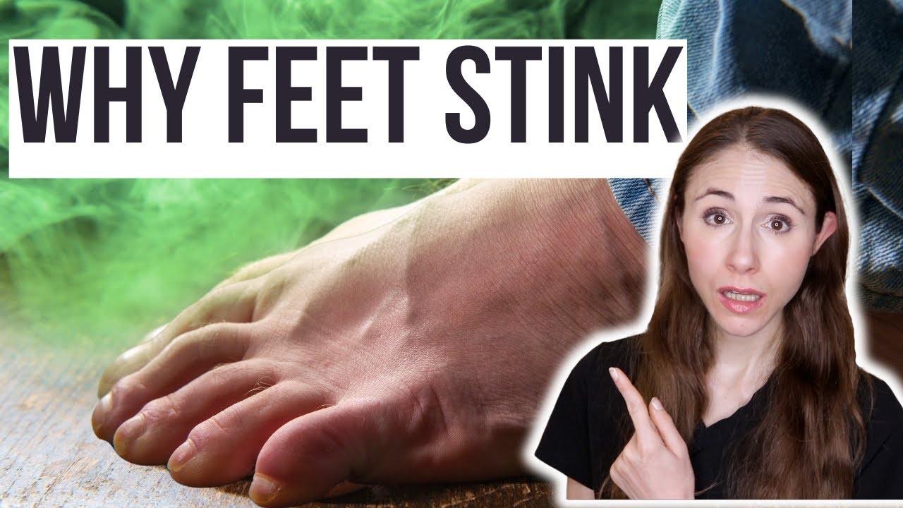 Why Your Feet Stink & How To Get Rid Of Foot Odor