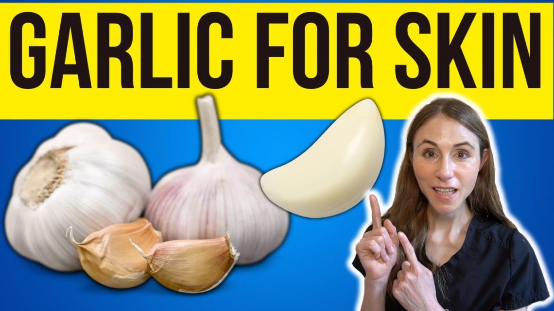 Amazing Benefits Of Garlic For Skin